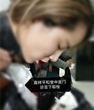 患者治疗